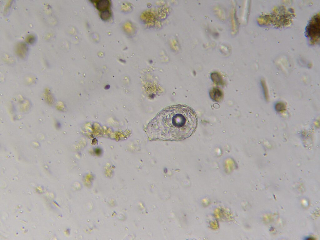 testate amoeba